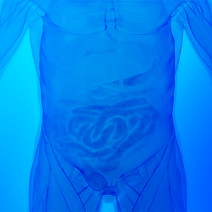 Hernias
